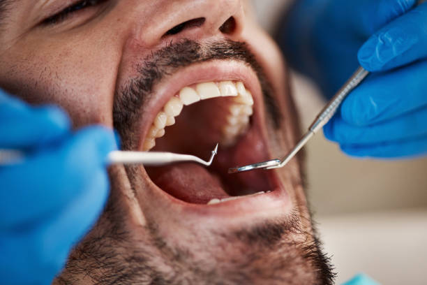 Best Broken Tooth Emergency  in Kerens, TX